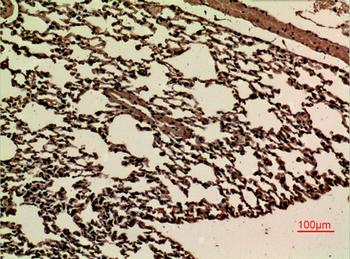 JAM-B Polyclonal Antibody