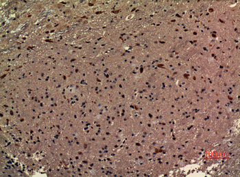 RRP7A Polyclonal Antibody