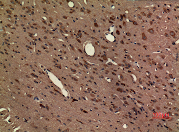 Fractalkine Receptor Polyclonal Antibody