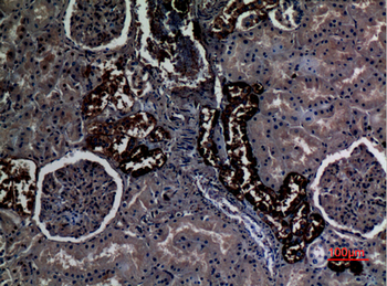 RhCG Polyclonal Antibody