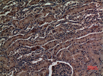 ZNF227 Polyclonal Antibody