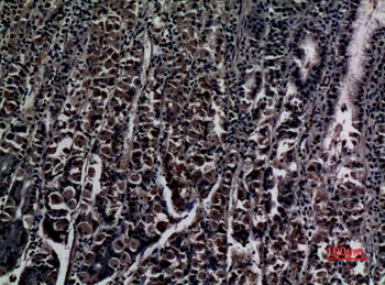 ZNF227 Polyclonal Antibody
