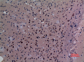 TudorSN Polyclonal Antibody