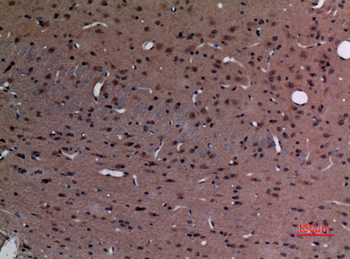 Stathmin-2 Polyclonal Antibody