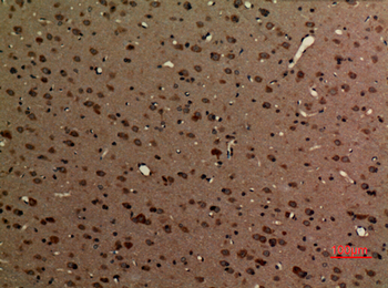 Myosin VI Polyclonal Antibody
