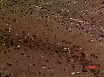 Myosin VI Polyclonal Antibody