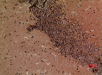 BOCT Polyclonal Antibody