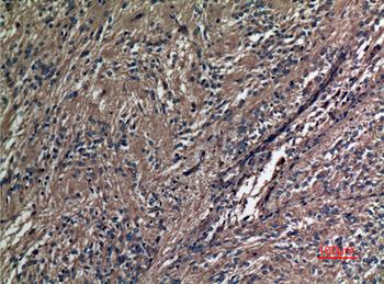 A1BG Polyclonal Antibody