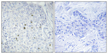 ZNF785 Polyclonal Antibody