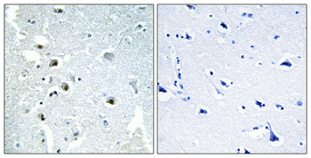 XPG Polyclonal Antibody