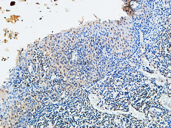 VDR Polyclonal Antibody