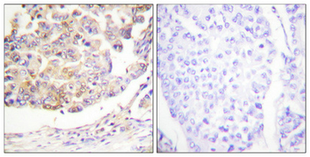 Vav Polyclonal Antibody