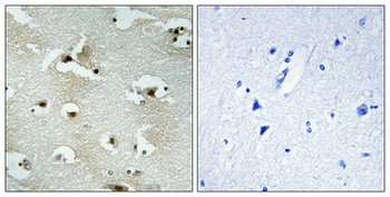 UTP14A Polyclonal Antibody