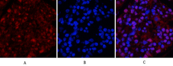 Tubulin β Polyclonal Antibody