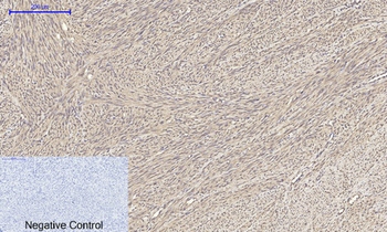 Tubulin α Polyclonal Antibody