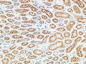 TIMP-2 Polyclonal Antibody