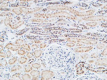 Tie-1 Polyclonal Antibody