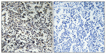 Thymidine Kinase Polyclonal Antibody