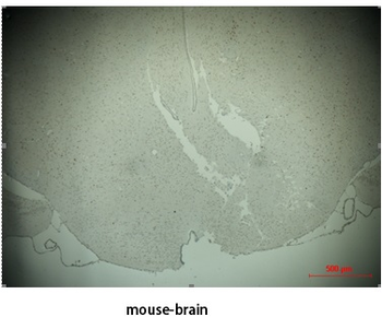 TH Polyclonal Antibody