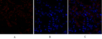 TGFβ RII Polyclonal Antibody