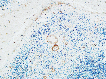 TdT Polyclonal Antibody