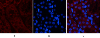 Tak1 Polyclonal Antibody