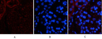 Tak1 Polyclonal Antibody