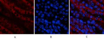 Tak1 Polyclonal Antibody