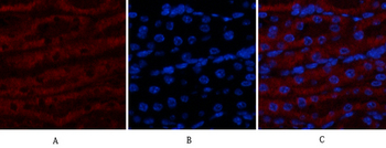 Tak1 Polyclonal Antibody