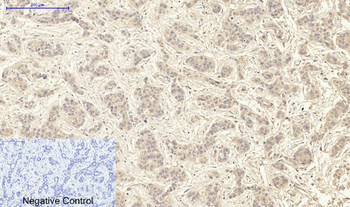 Tak1 Polyclonal Antibody