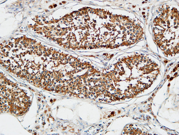 TACC3 Polyclonal Antibody