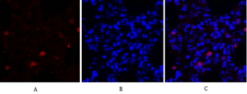 Survivin Polyclonal Antibody