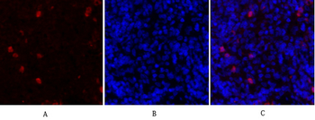 Survivin Polyclonal Antibody