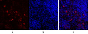 Survivin Polyclonal Antibody