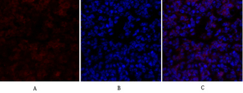 Survivin Polyclonal Antibody
