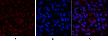 Stat1 Polyclonal Antibody