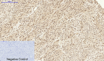 Stat1 Polyclonal Antibody