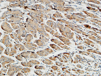 Somatostatin Polyclonal Antibody