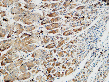 Somatostatin Polyclonal Antibody