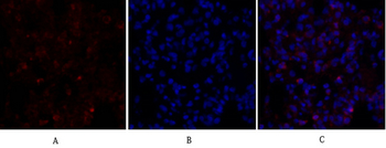 Smad4 Polyclonal Antibody