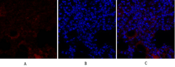 Smad4 Polyclonal Antibody