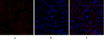 Smad4 Polyclonal Antibody