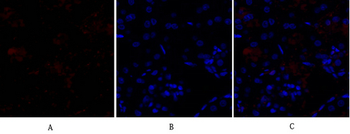 Smad3 Polyclonal Antibody