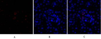 Smad3 Polyclonal Antibody