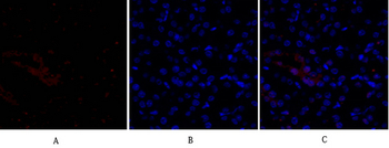 Smad3 Polyclonal Antibody