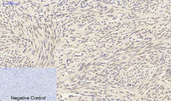 Smad3 Polyclonal Antibody