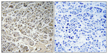 Smad3 Polyclonal Antibody