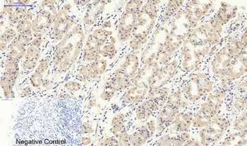 Smad2/3 Polyclonal Antibody