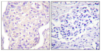 SH-PTP2 Polyclonal Antibody