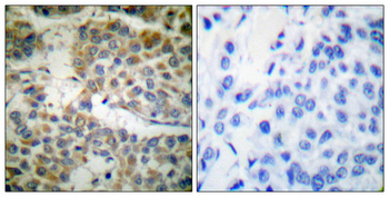 Shc Polyclonal Antibody